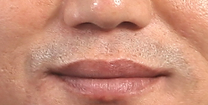 injoong.PNG : 13일을 밝히는 첫글